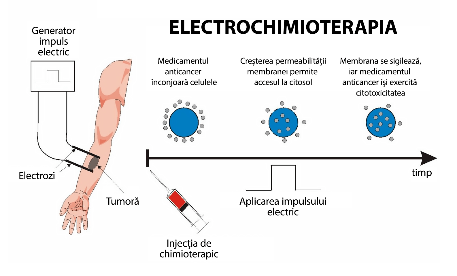 Electrochimioterapia schema