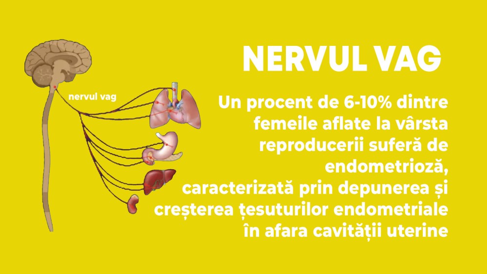 Treatment of endometriosis by vagus nerve stimulation